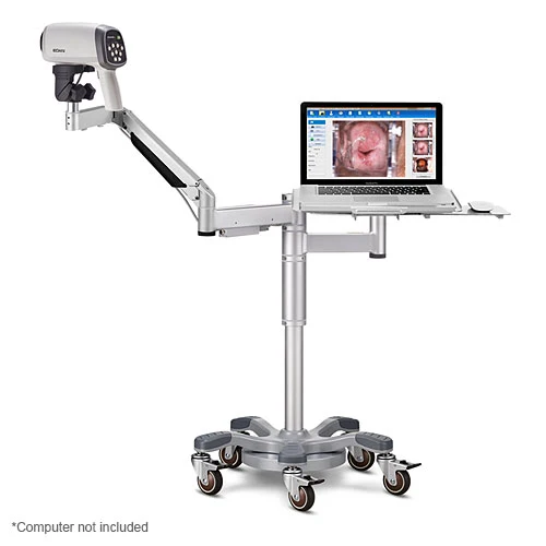 EDAN C6AHD_Arm_Tray Colposcope w/40 LEDs, HD Camera, Swing Arm Stand & PC Tray
