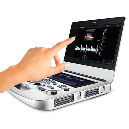 EDAN Acclarix® AX3 Digital Ultrasound Imaging System w/Choice of Transducer, 15" HD Color Touch Screen