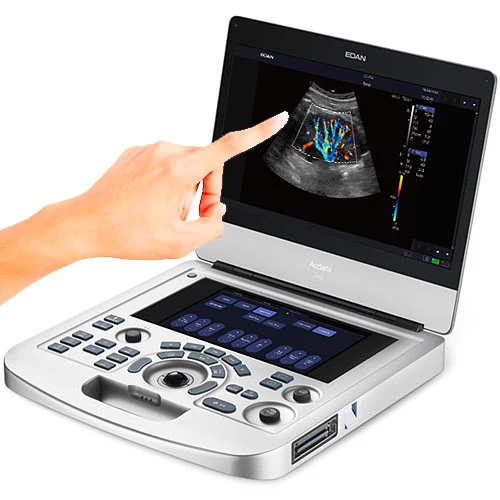 EDAN Acclarix® AX2 Digital Ultrasound Imaging System w/Choice of Transducer, 15" HD Color Touch Screen