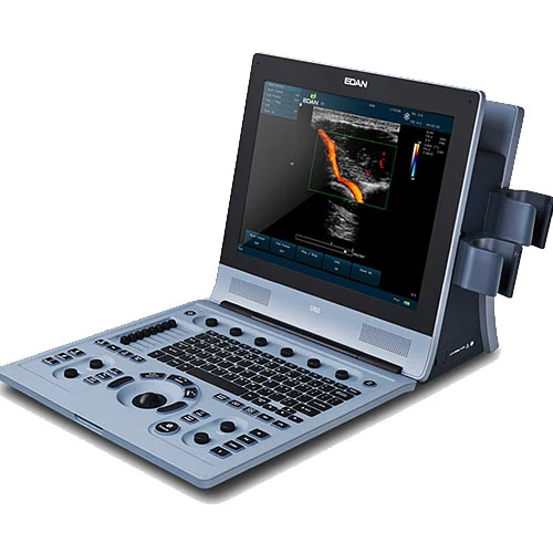 EDAN U60 Digital Ultrasound Imaging System w/Choice of Transducer, 15.1" LCD Color Screen
