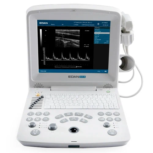 EDAN DUS60 Digital Ultrasound Imaging System w/Choice of Transducer, 12.1" LCD Screen