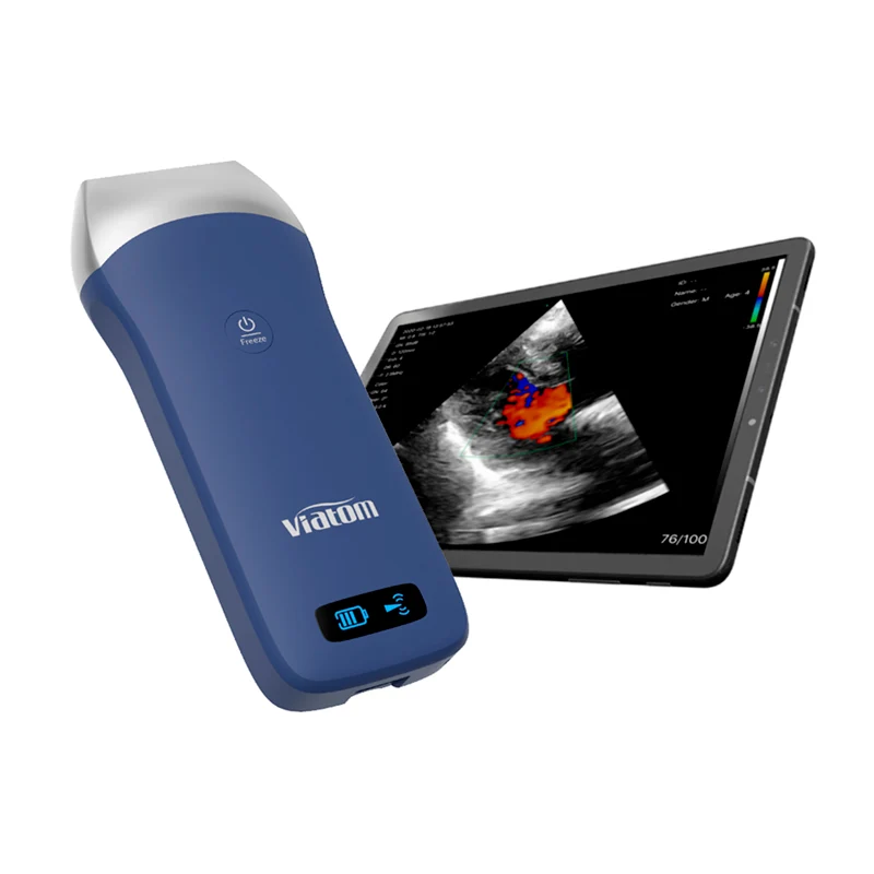 Ecógrafo Lineal Inalámbrico Portátil VIATOM