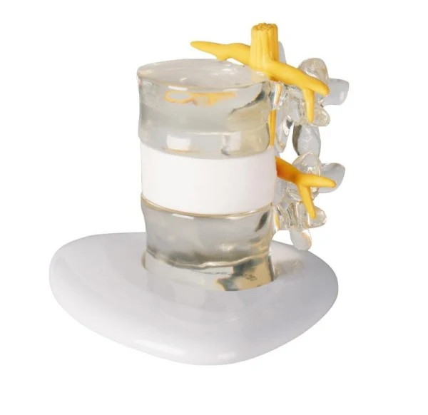 Simulador de hernia discal