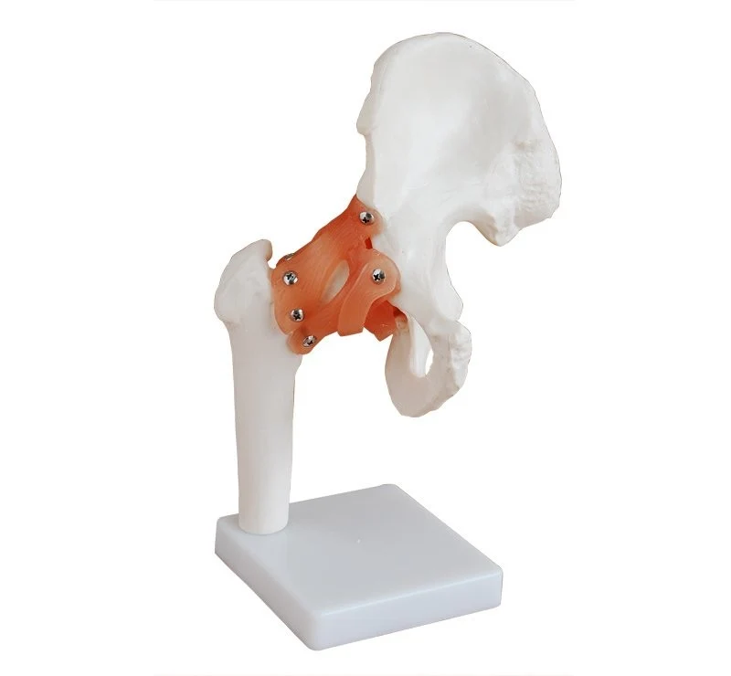 Articulación de la cadera