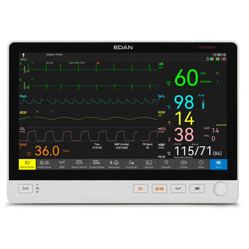 EDAN 13.3" Touch Screen Patient Monitor, ECG, Resp., NIBP, SpO2, 2-TEMP, PR, WiFi™, UX12