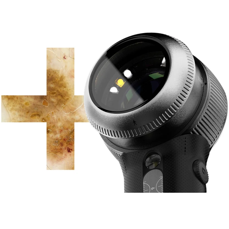 DermLite® DL5+™ (PLUS) Hybrid Dermatoscope w/10 x Magnification, Adjustable Polarization, DL5P