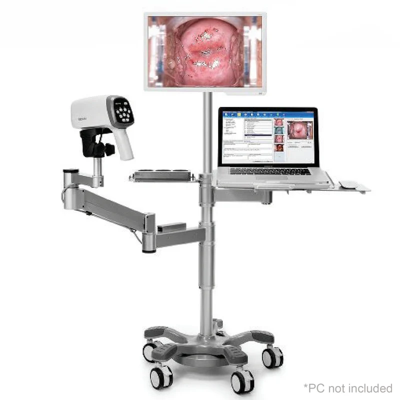 EDAN C6AHD_Arm_Tray_Monitor Colposcope w/40 LEDs, HD Camera, Swing Arm Stand, PC Tray & Monitor